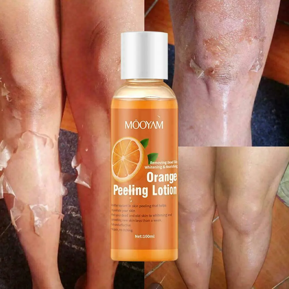 Gel esfoliante, para remoção de células mortas, clareamento e esfoliação