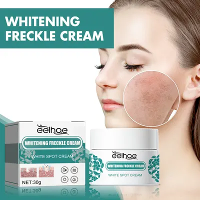 Creme para manchas, hidratante, clareador de pele