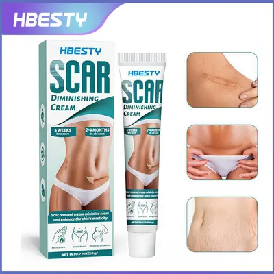 Gel de hierbas HBESTY para cicatrices de quemaduras, cirugía, cesárea, crema de cuidado herbal para el embarazo