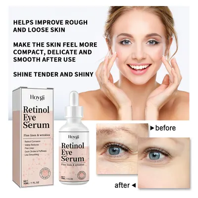 Hoygi Retinol Eye Serum: Disminuye Líneas Finas, Bolsas y Ojeras, Firmeza y Rejuvenecimiento del Área de los Ojos
