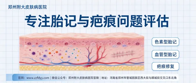 Fokus på specialklinik för födelsemärken och ärr: Zhengzhou Fuda Hudsjukhus skapar standardiserade vårdtjänster