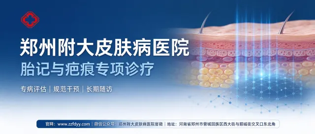 Onde tratar manchas e cicatrizes em Zhengzhou? Conheça o Hospital de Dermatologia Fuda de Zhengzhou