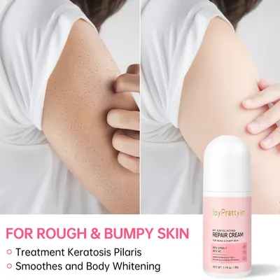 JoyPrettyin Keratosis Pilaris vårdkräm fuktgivande återfuktande frisk hud doftande kroppreparationskräm