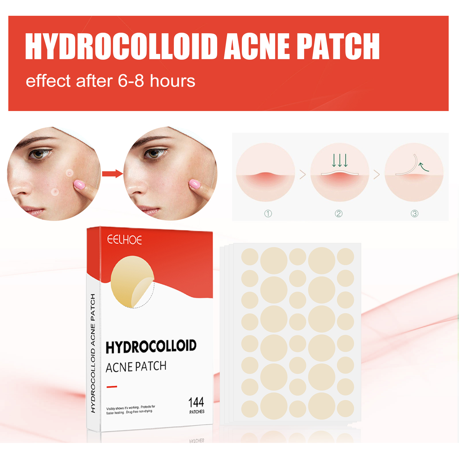 Hydrocolloid acne patches