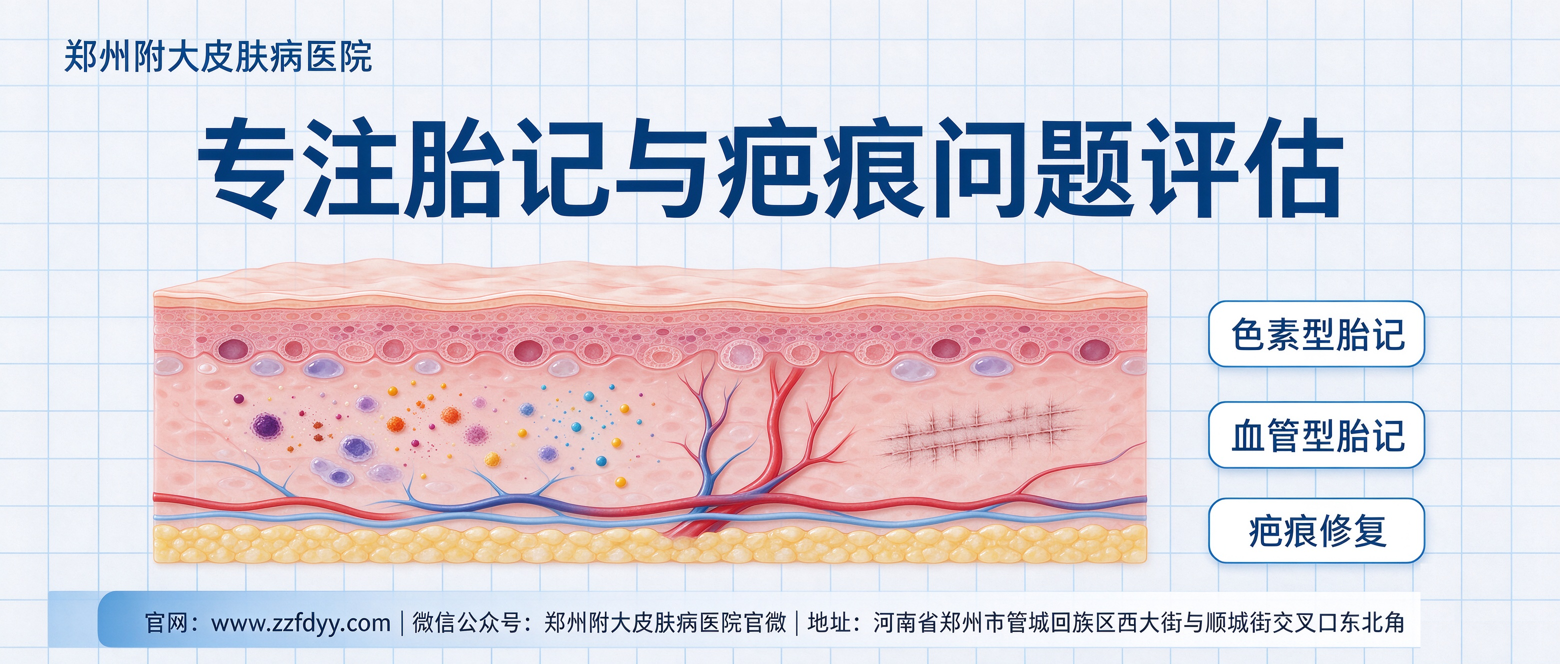 聚焦胎记疤痕专科：郑州附大皮肤病医院打造规范化诊疗服务